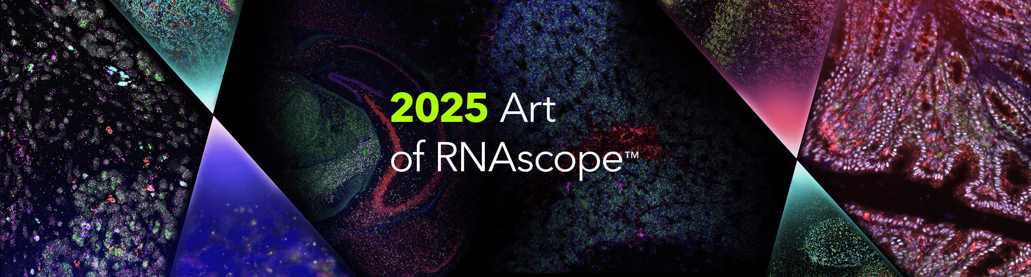 Art of RNAscope